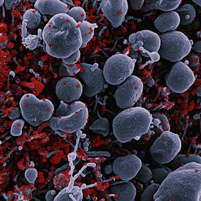 How Ancient Archaea Shape Your Metabolism EP140