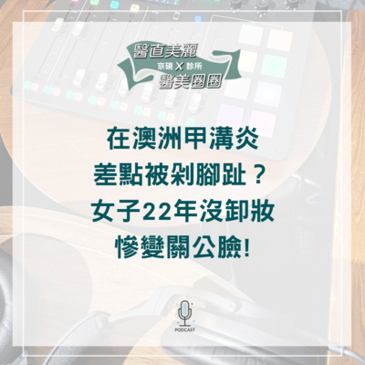 【S2 EP.067】在澳洲甲溝炎差點被剁腳趾？ 女子22年沒卸妝慘變關公臉!