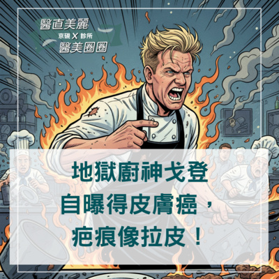 【S2 EP.084】地獄廚神戈登自曝得皮膚癌,疤痕像拉皮!