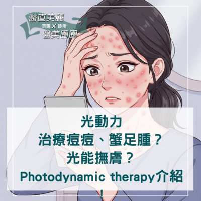 【S2 EP.087】光動力(PDT) 治療痘痘、蟹足腫?光能撫膚? Photodynamic therapy介紹