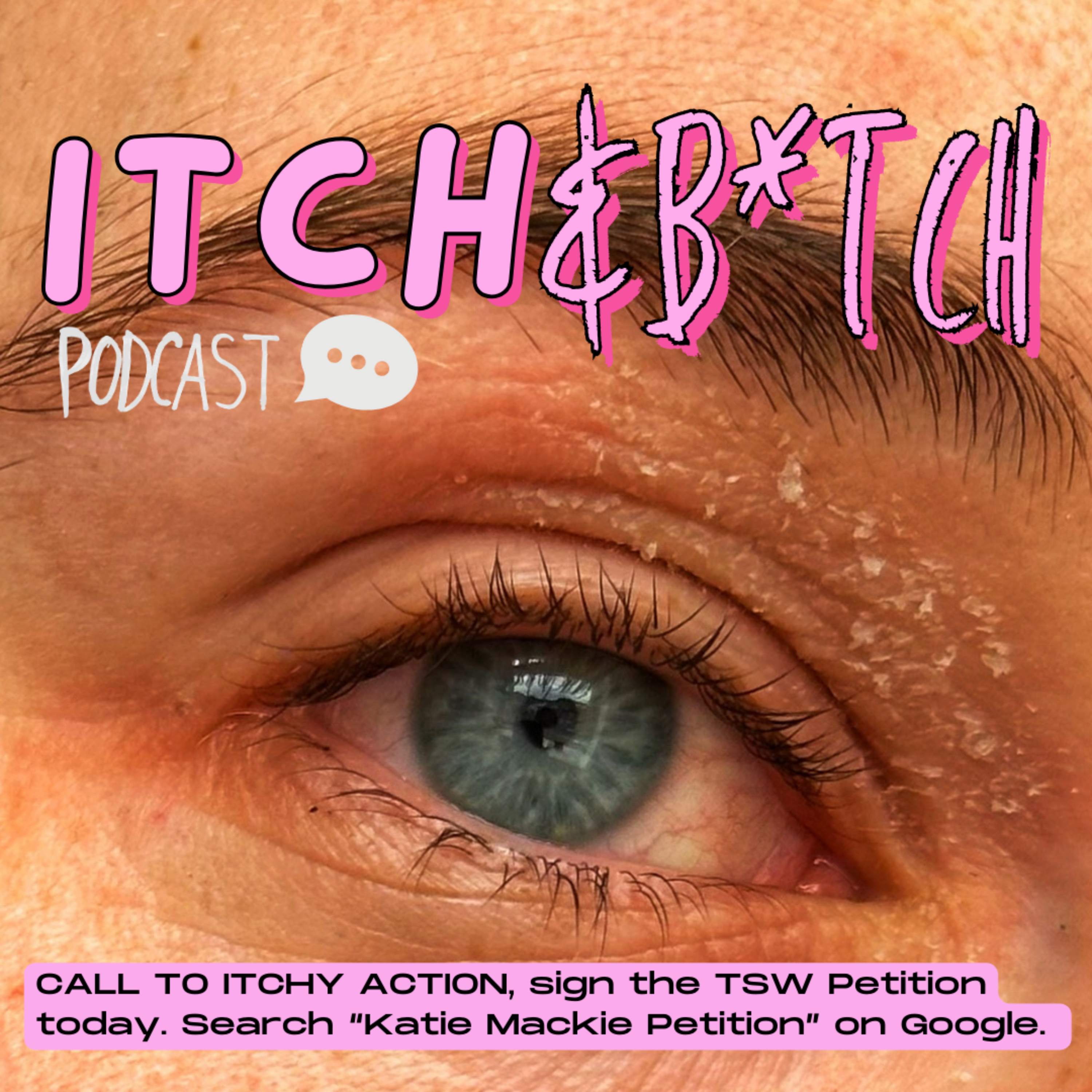 Itch N Bitch X Westlab Salts - Mental health + Visual differences live chat