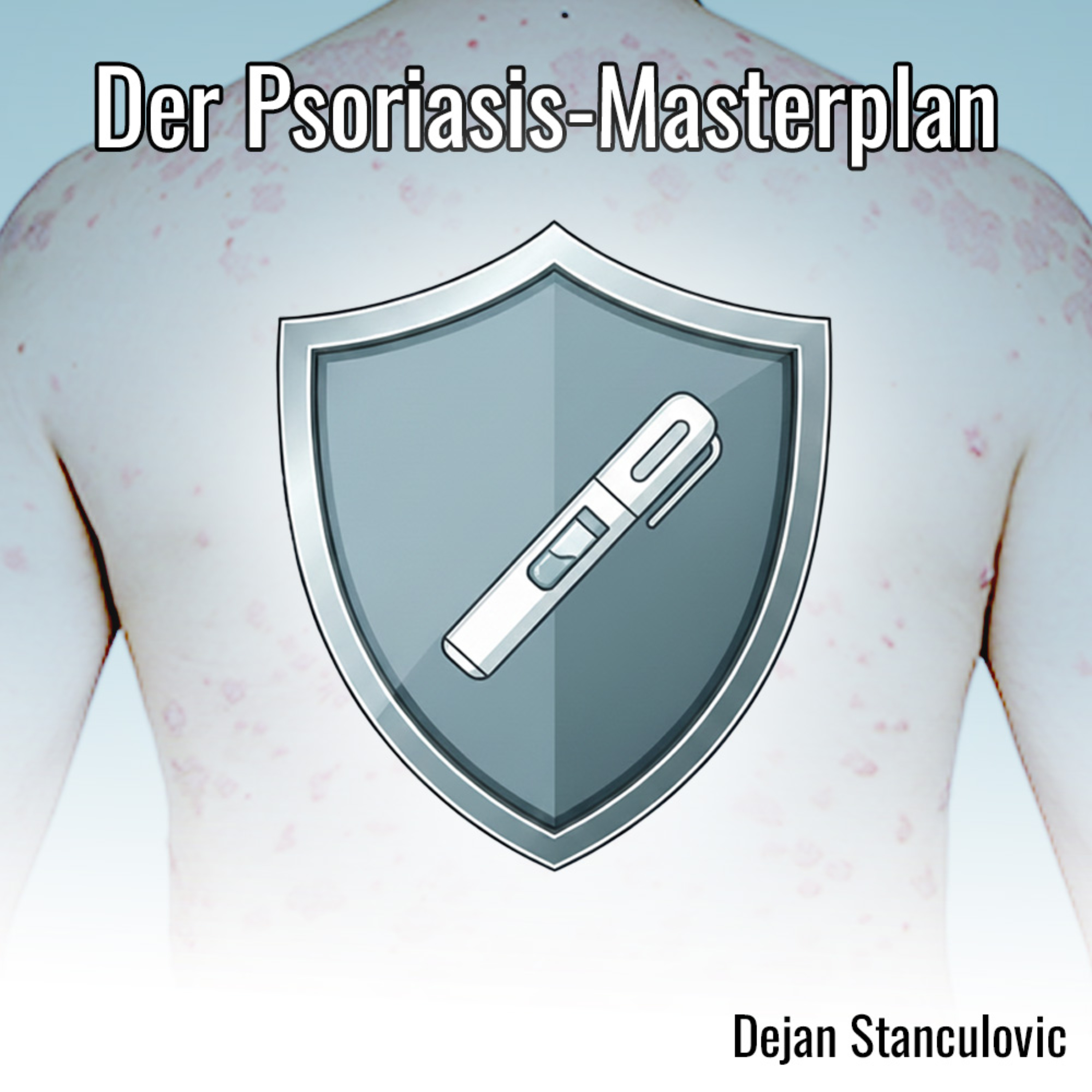 Dejan Stanculovic - Psoriasis-Masterplan