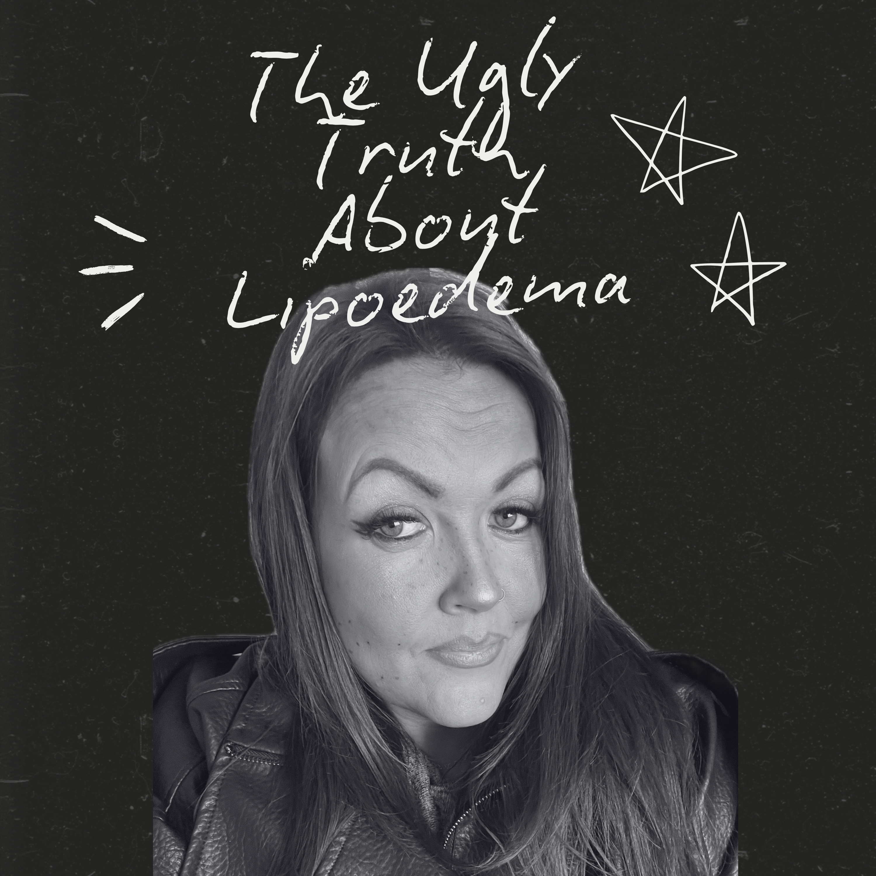 The Ugly Truth About Lipoedema 