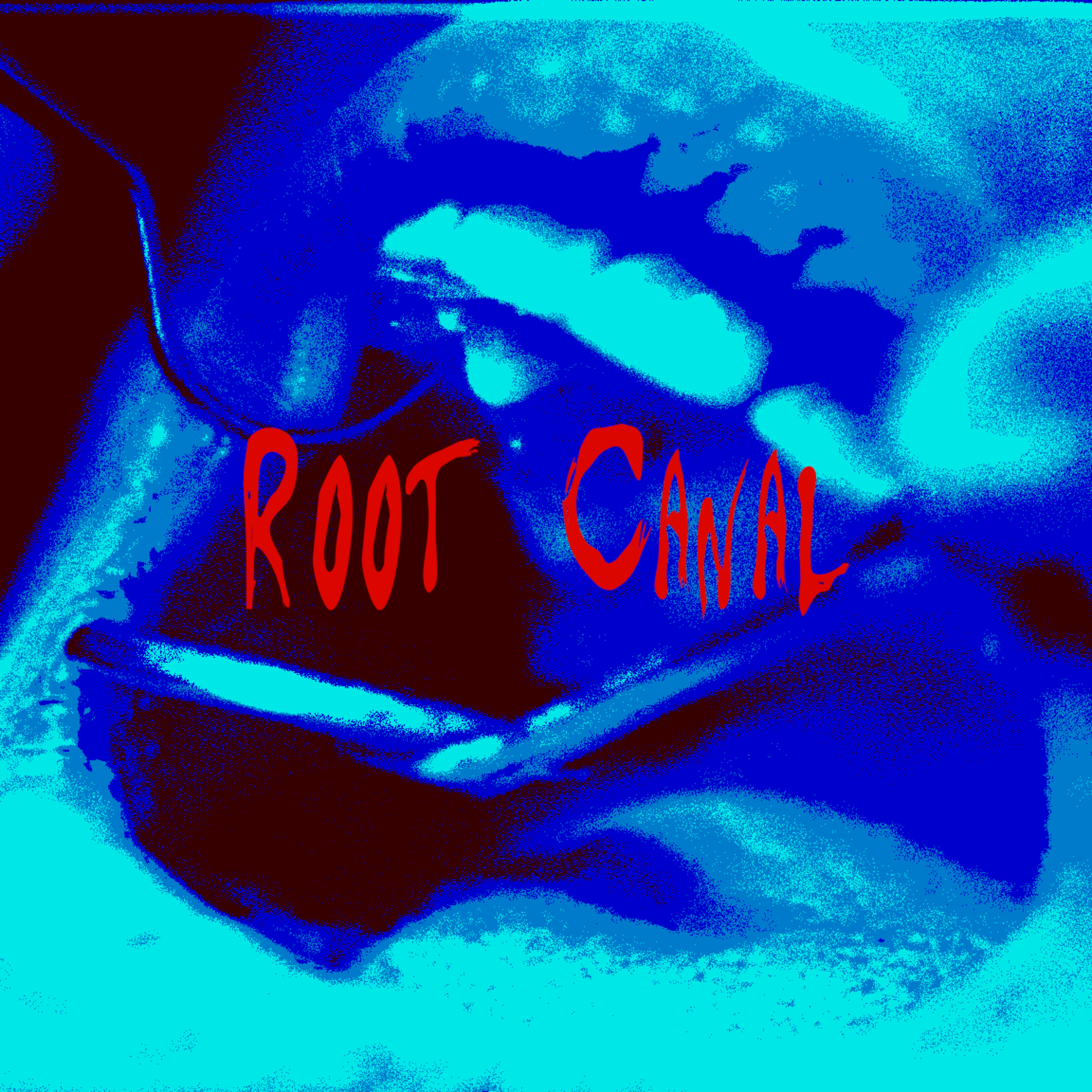 Root Canal