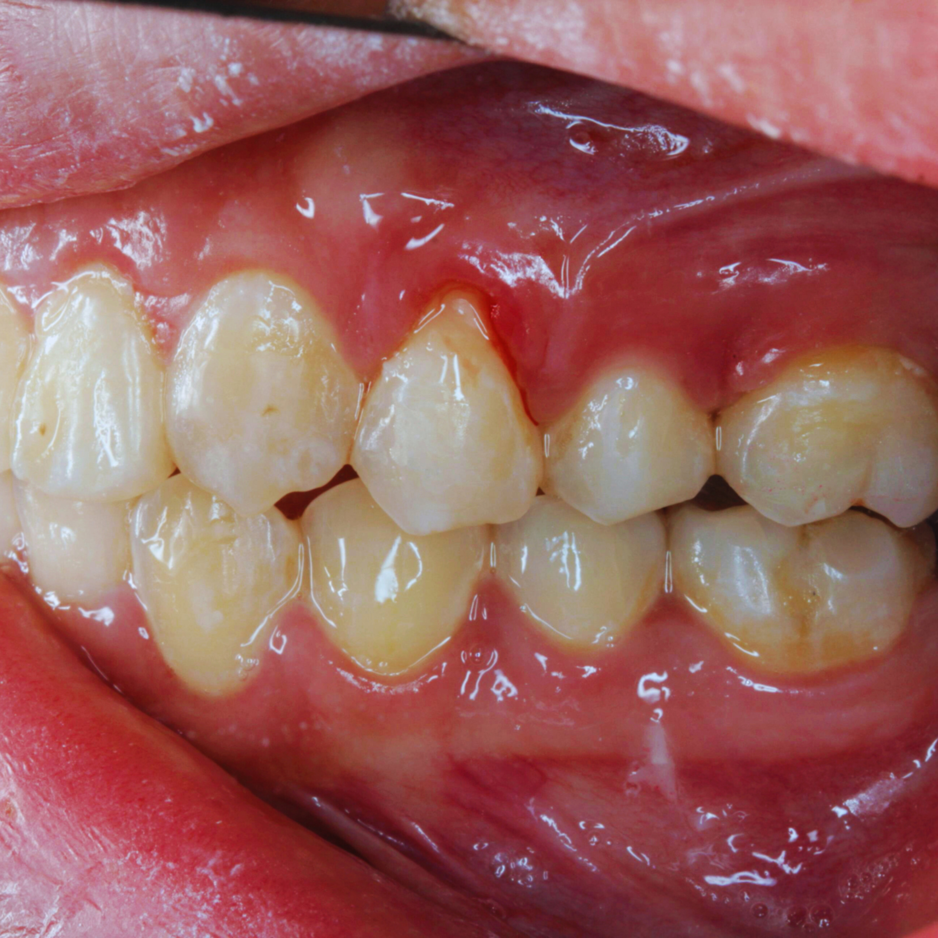 Missing Teeth or Bleeding Gums Dentists Can Help