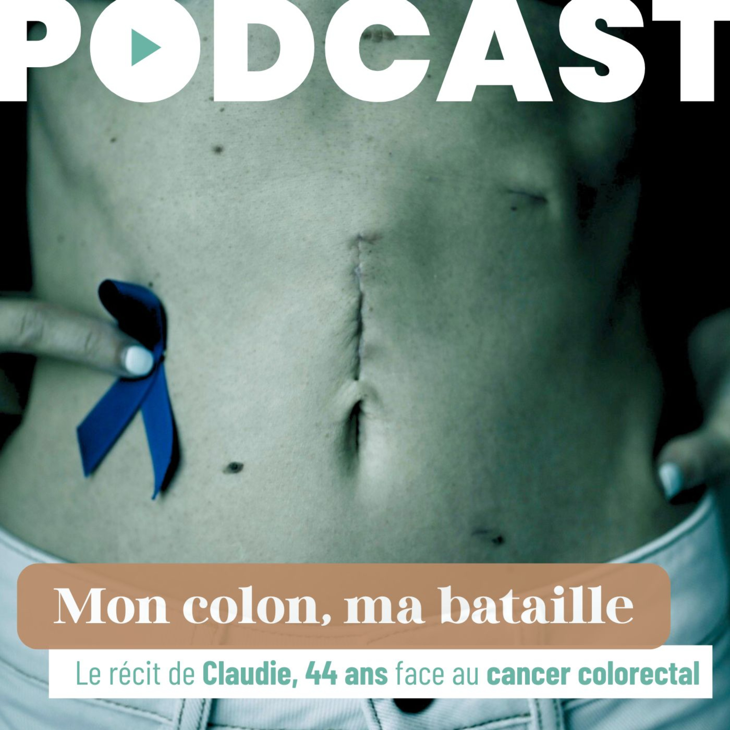 Mon colon ma bataille : le récit de Claudie, 44 ans, face au cancer colorectal