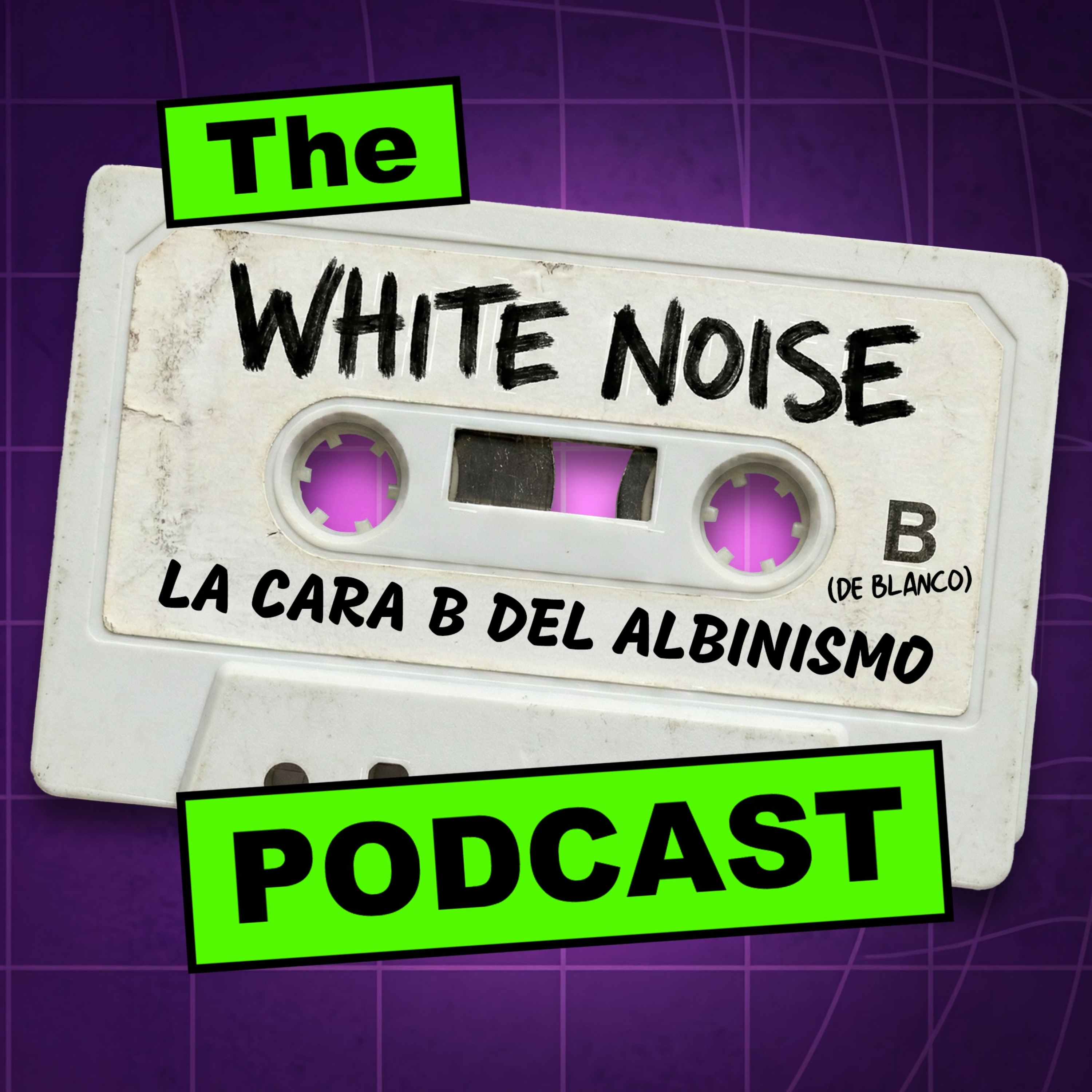 White Noise | La cara B del albinismo