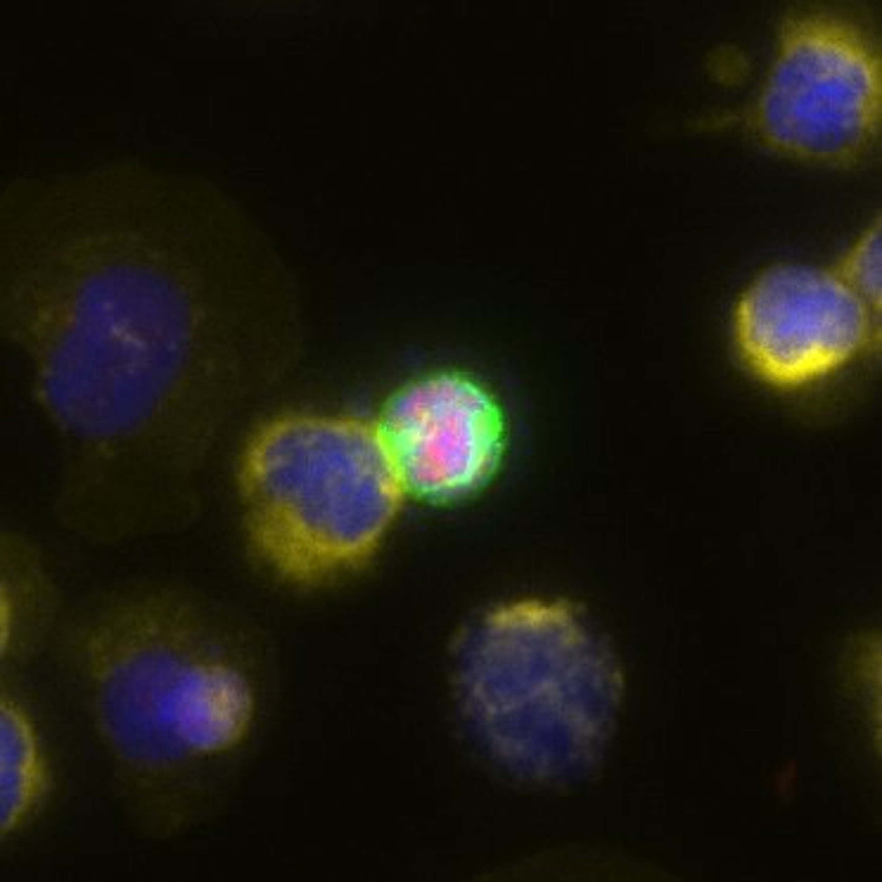Cells in Motion: The Future of Cancer Monitoring